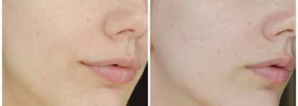 Прекрасный уход на лето с увлажняющей сывороткой Don’t Touch My Skin
