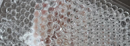 Три быстрых способа устранения утренних отеков под глазами