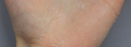 Пилинг-скатка от Limoni с экстрактом яблока и АНА кислотами