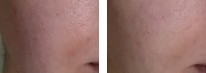 Пенка для умывания A'Pieu Madecassoside Cleansing Foam