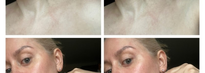 Мал, да удал. Роликовый массажер для лица и тела Face and Body 3D Roller Yamaguchi