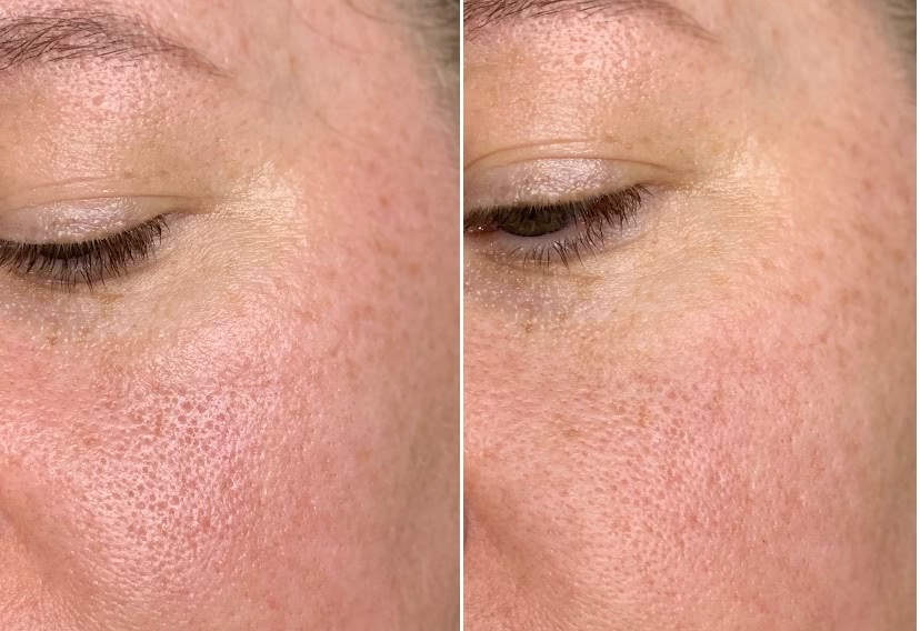 Слева кожа с уходом, справа - нанесен праймер Shiseido WASO Pores Invisibles