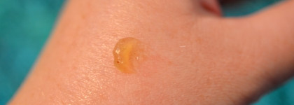 Коллекция бальзамов для губ. Прозрачные помощники