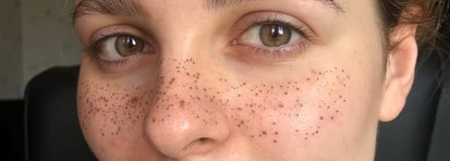 Ода природной красоте принцессы Авроры в образе soft-girl. Учимся создавать фейковые веснушки