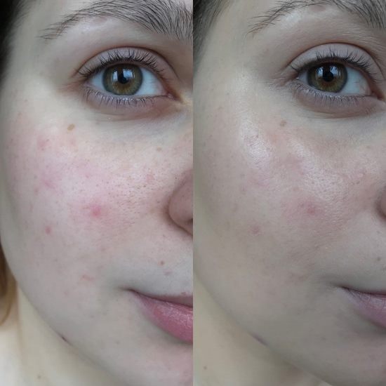 Правда ли это райское средство для кожи? Тонирующий флюид L'Oreal Paris Skin Paradise Tinted Water Cream Spf-20 02 Fair