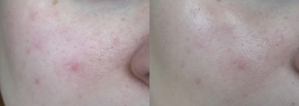 Правда ли это райское средство для кожи? Тонирующий флюид L'Oreal Paris Skin Paradise Tinted Water Cream Spf-20 02 Fair