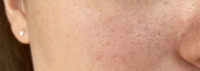 Самое бережное очищение сухой кожи с Clarins Doux Nettoyant Moussant Hydratant