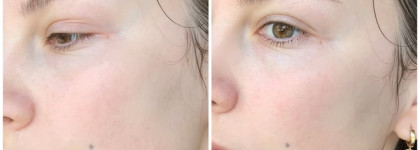 Пока еще не поздно пить Боржоми. Мой уход от Filorga, Dr. Jart+, Sisley