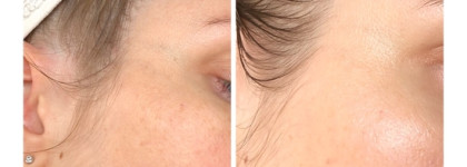 Работающая парочка от Derma E