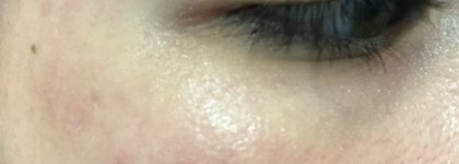 Немного о сыворотке от FACT. - 3D Hyaluronic Acid + Caffeine + EGCG Сыворотка вокруг глаз от отеков и темных кругов