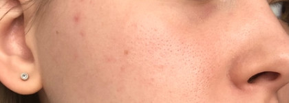 Purito Cica Clearing BB cream - отличник среди корейских Bb-Кремов