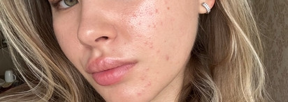 Мой летний маст хэв - Sesderma Azelac Ru Luminous fluid cream SPF50