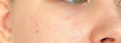 Лучший для жирной кожи: Ma:nyo Galactomy Moisture Sun Serum Spf50+ PA++++