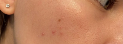 Уход за проблемной кожей с Skinjestique: сыворотка-эксфолиант Pore Perfection BHA serum и крем Better than makeup cream