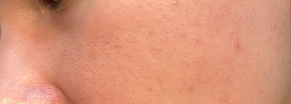 Мой идеальный ретиналь: Don’t Touch My Skin Retinal