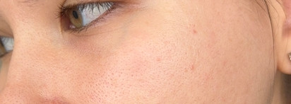 Мой идеальный ретиналь: Don’t Touch My Skin Retinal