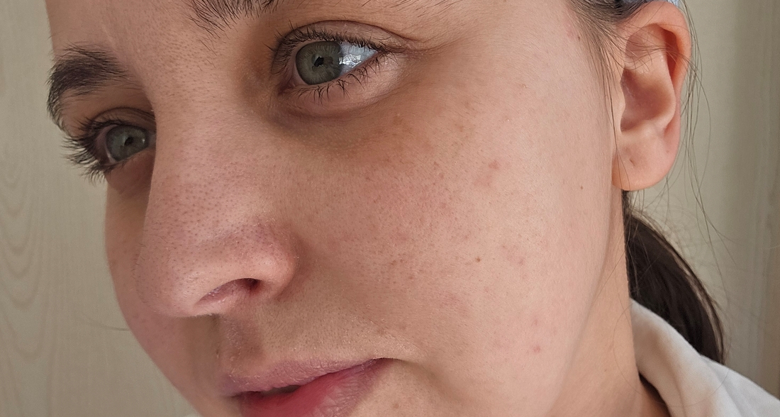 До применения