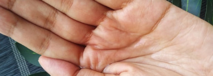 Такой неоднозначный Rovectin. Хэштег средств марки #данетнаверное