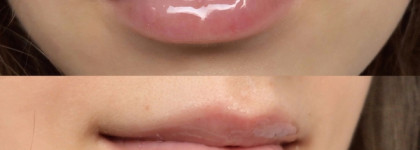 До скорой встречи, моя любовь к тебе навечно! Или нет? Суд над "летними" блесками для губ