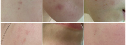 Organic Kitchen Don’t touch my face увлажняющая отшелушивающая сыворотка с молочной кислотой