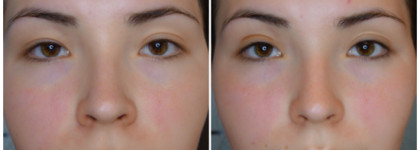 Макияж Ани Тейлор-Джой на церемонии вручения «Эмми» 2021