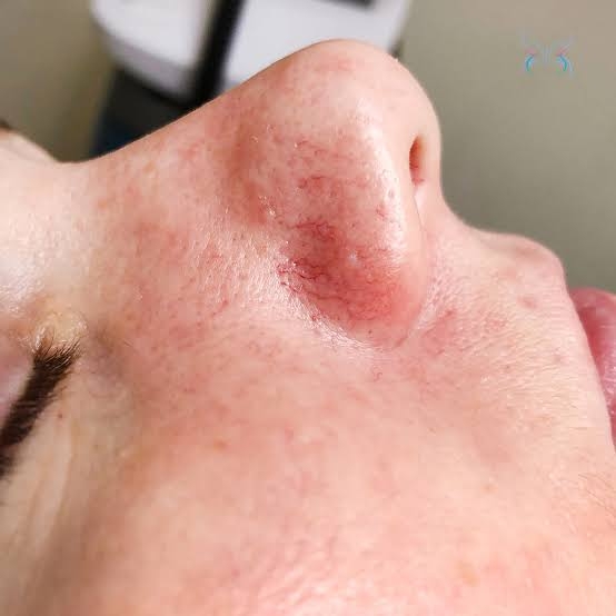 Вот у меня так