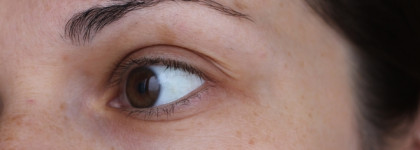 Гельтек Anti-Age Концентрат Омолаживающий 5 peptides - работа на возрастной коже до/после