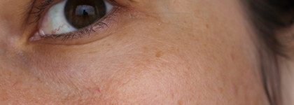 Гельтек Anti-Age Концентрат Омолаживающий 5 peptides - работа на возрастной коже до/после