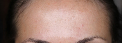 Уход за проблемной кожей средствами от Гельтек