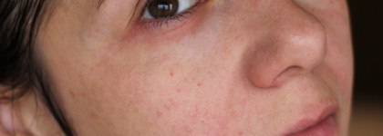 Крем для лица La Roche Posay Toleriane Dermallergo - SOS средство после кислотных пиллингов