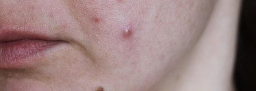 Ампульная сыворотка Graymelin галактомицет - мой ластик от несовершенств