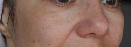 Ампульная сыворотка Graymelin галактомицет - мой ластик от несовершенств