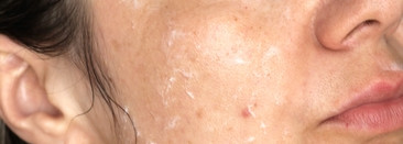 Raise Perfect One Cream - легендарный крем-утюжок от морщин в действии на коже 40+