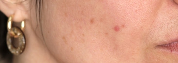 Raise Perfect One Cream - легендарный крем-утюжок от морщин в действии на коже 40+