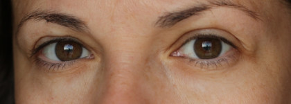 Знакомство с брендом Booster Bar - лимфодренаж и анти эйдж после 40 лет. До/после