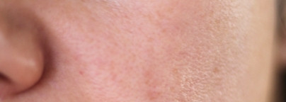 Почему Мадонна выбирает астаксантин? Почему я выбираю Graymelin Astaxanthin stemcell toner