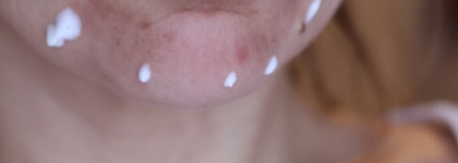 Классная парочка от Openface для реабилитации кожи после пилинга Джесснера