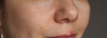 Тональный BB крем от Limoni Hyaluronic Ultra Moisture эффект словно после 10 часов сна