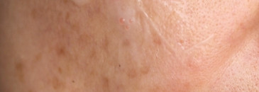 Red Lacto Collagen Cream от Medi-Peel абсолютное разочарование и деньги на ветер