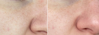 Deep Clean AHA-Mask маска очищающая с глиной и AHA-кислотами от Aravia Professional