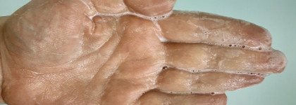 Уход за проблемной кожей: что понравилось и подошло в 2021