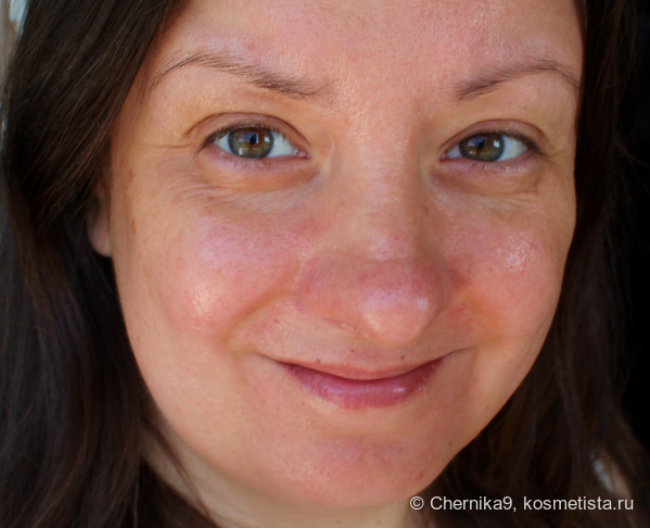 Кожа после флюида