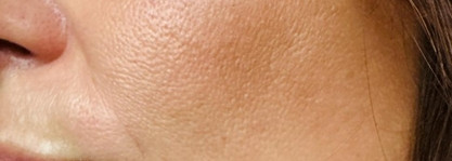 Мой лучший бронзер Catrice Sun Lover Glow Bronzing Powder в оттенке 010 Sun-kissed Bronze. С ним я всегда выгляжу так, словно только что вернулась из отпуска