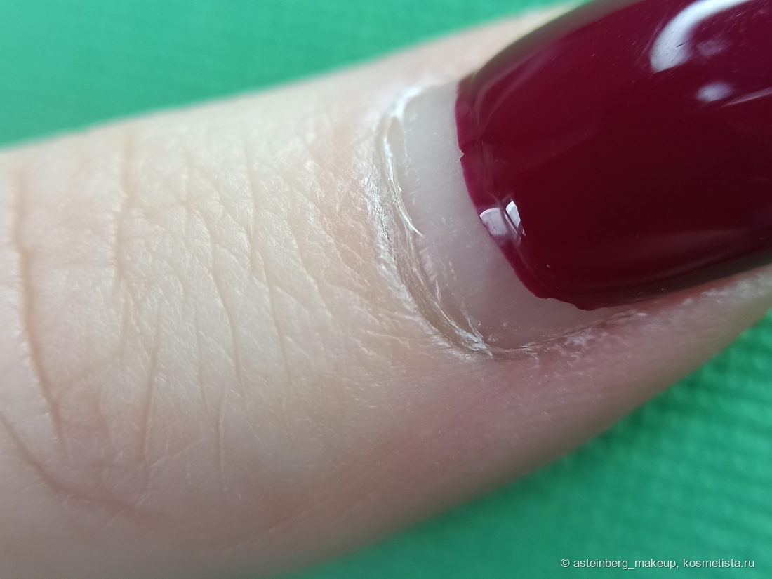 Кожа вокруг ногтевой пластины до применения Aravia Rich Cuticle Oil с маслом авокадо и витамином E