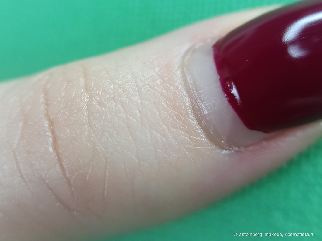 Кожа вокруг ногтевой пластины после применения Aravia Rich Cuticle Oil с маслом авокадо и витамином E