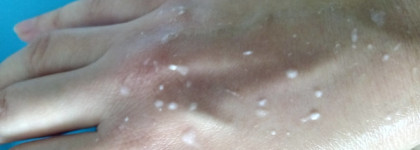 Битва двух скаток: Secret Key Lemon Sparking Peeling gel vs Bielita White Detox Премиум пилинг-скатка «Минеральное очищение и матирование»