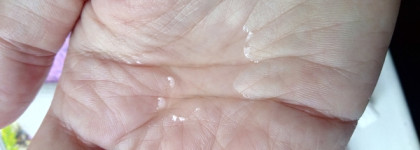 Пилинг Icon Skin 18% Anti-Acne Smart Peel System