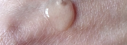 Любимый продукт для жирной кожи: сыворотка для лица Niacinamide 10% + Zinc 1% Art&Fact