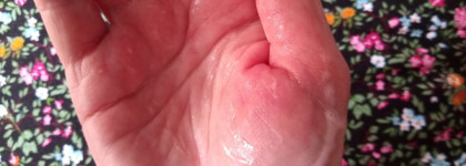 Средства, которые помогли мне пережить лето