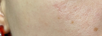 Dior Diorskin Forever Undercover 005: как вообще можно было создать такое недоразумение?